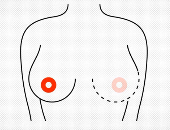 Rak n Roll cancer poland