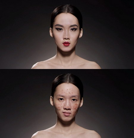 face for sale pornkasem clinic 3-vert 2