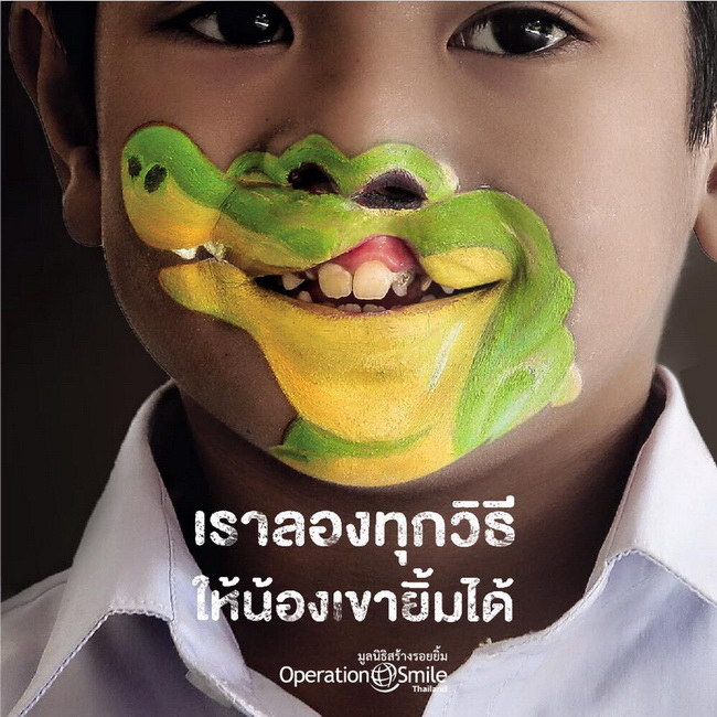 operation smile poster2