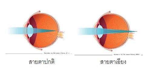 กระจกตา